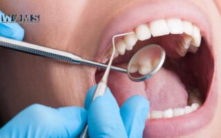 How to Know If I Need a Root Canal Treatment