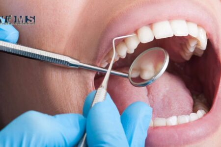 How to Know If I Need a Root Canal Treatment