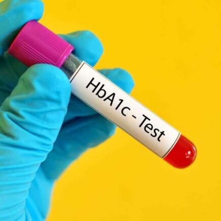 What Is HbA1C
