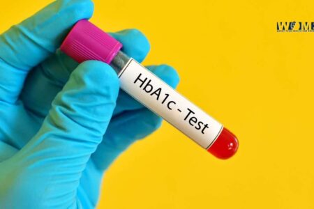What Is HbA1C